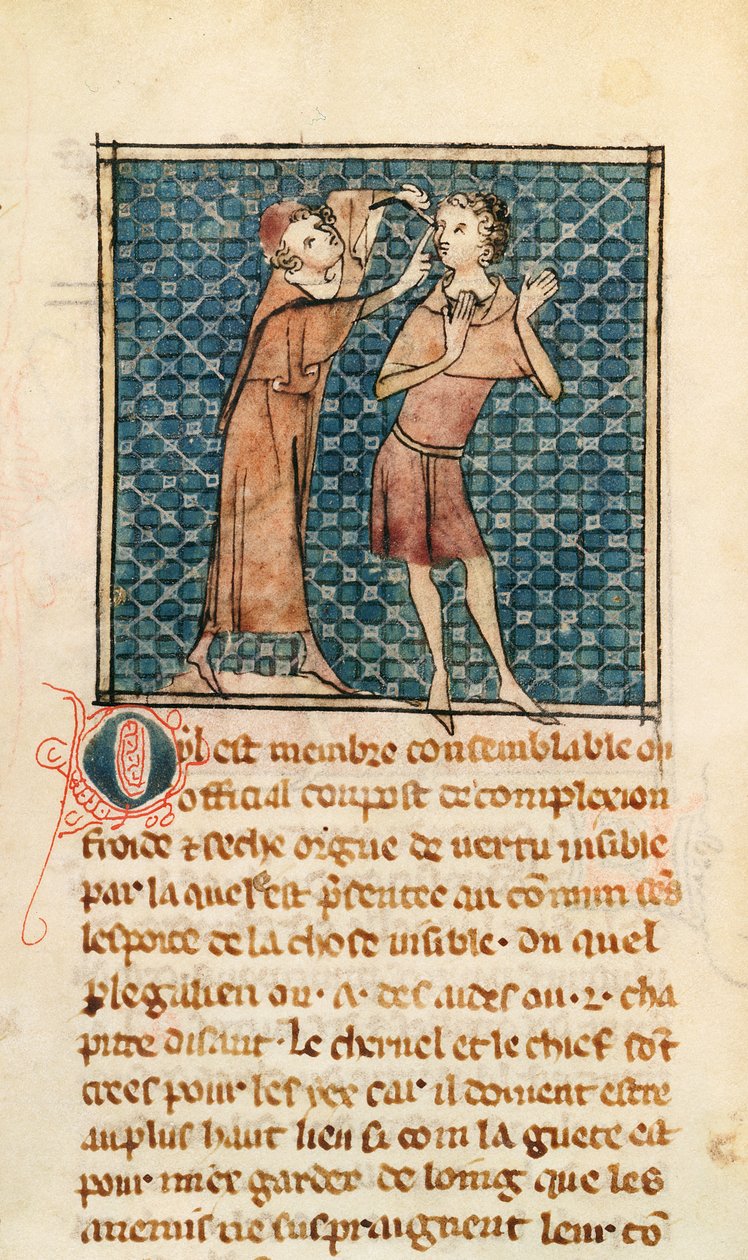 Ms 2030 fol.17 Oftalmologie, ilustrace z La Chirurgie de Maitre Henri de Mondeville od French School