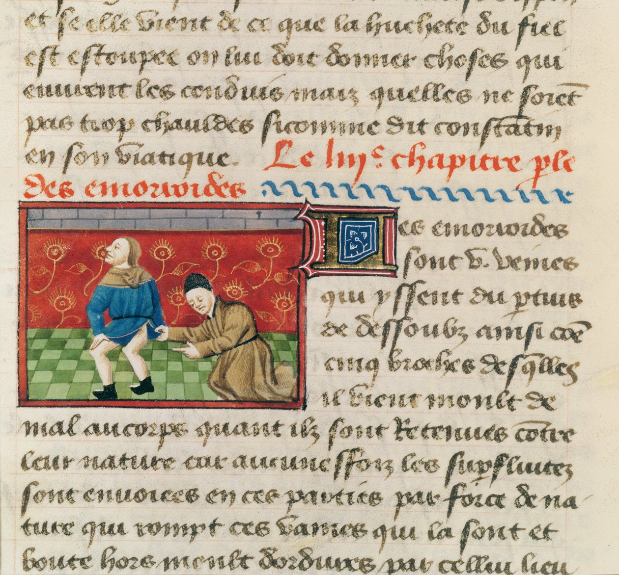 Ms 22532 Vyšetření pacienta s hemoroidy, z knihy Le Livre des Proprietes des choses od Barthelemyho lAnglais, asi 1410-15 od French School