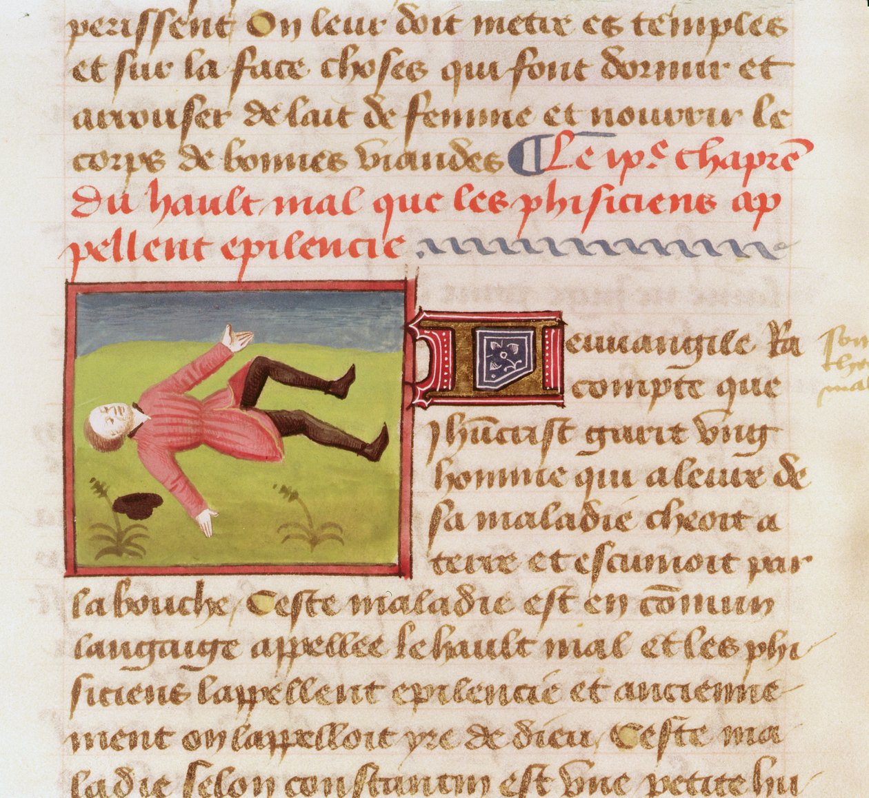 Ms 22532 Pacient trpící epileptickým záchvatem, z knihy The Book of the Properties of Things od Barthelemyho lAnglaise, c. 1410-15 od French School