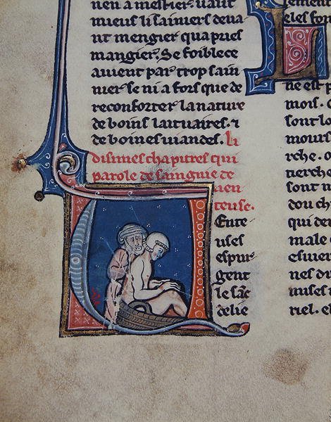 Ms 2510 Auskultace nemocného (pergamen) od French School