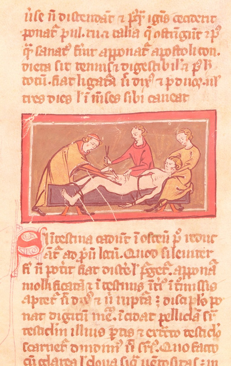 Ms H 89 fol. 23 Chirurgie, z vydání Knihy chirurgie od Rogiera de Salerne od French School