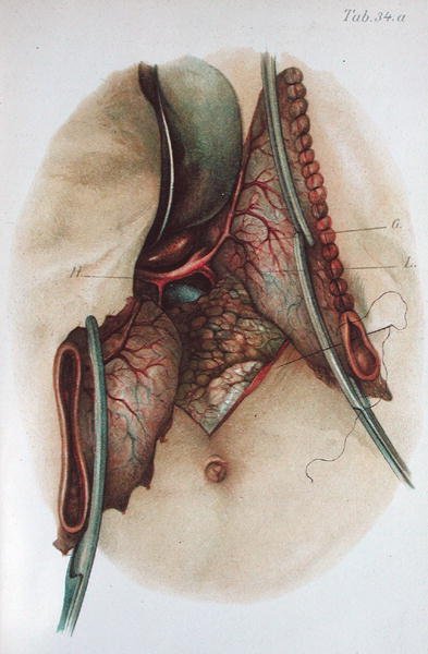 Talíř z „Atlasu a ztělesnění operativní chirurgie“ od Dr. Otto Zuckerkandla (1861-1921) 1910 (barevná rytina) od French School