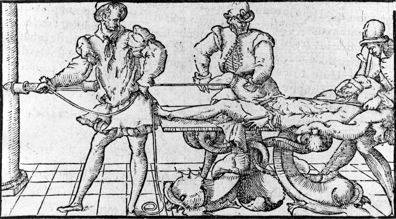 Redukce dislokace, -v „Lékařské smlouvě Ambroise Paré“, kolem roku 1560. od French School
