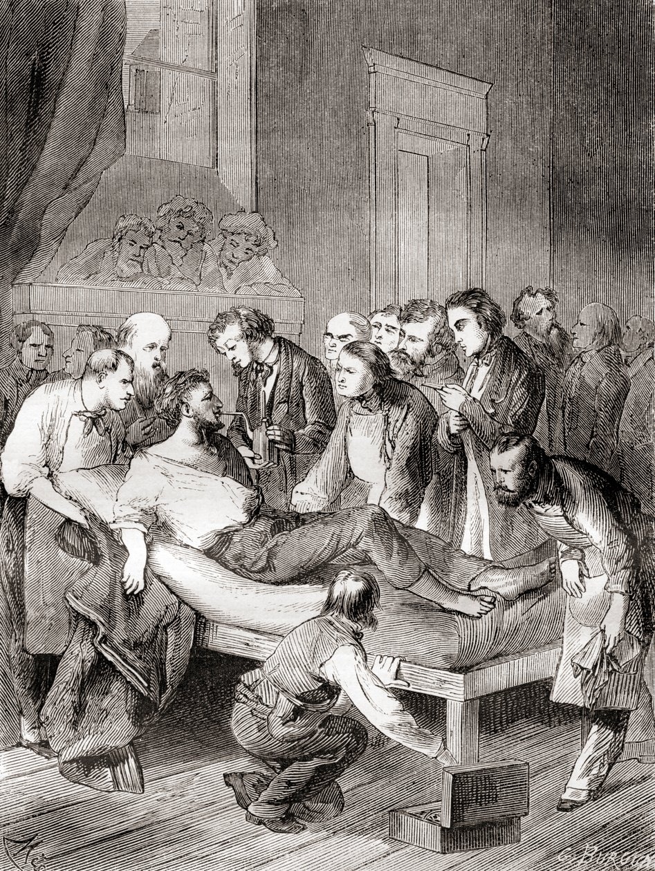 První veřejná demonstrace použití inhalovaného éteru jako chirurgického anestetika v roce 1846 americkým zubařem Williamem Thomasem Green Mortonem z „Les Merveilles de la Science“, publikovaná kolem roku 1870 od French School