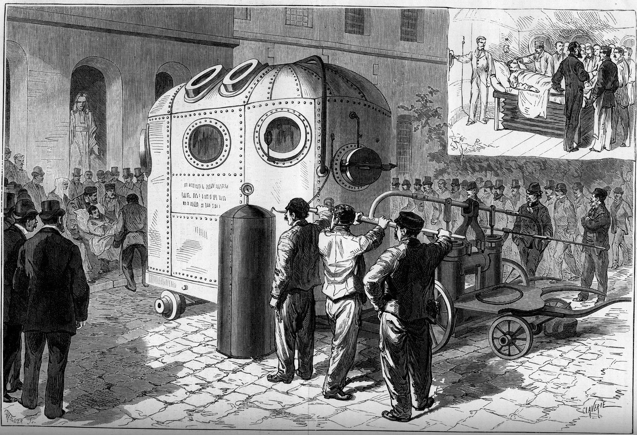 Pneumatický zvon používaný k anestezii pacientů při chirurgických operacích. Nemocnice Saint Louis v Paříži od French School