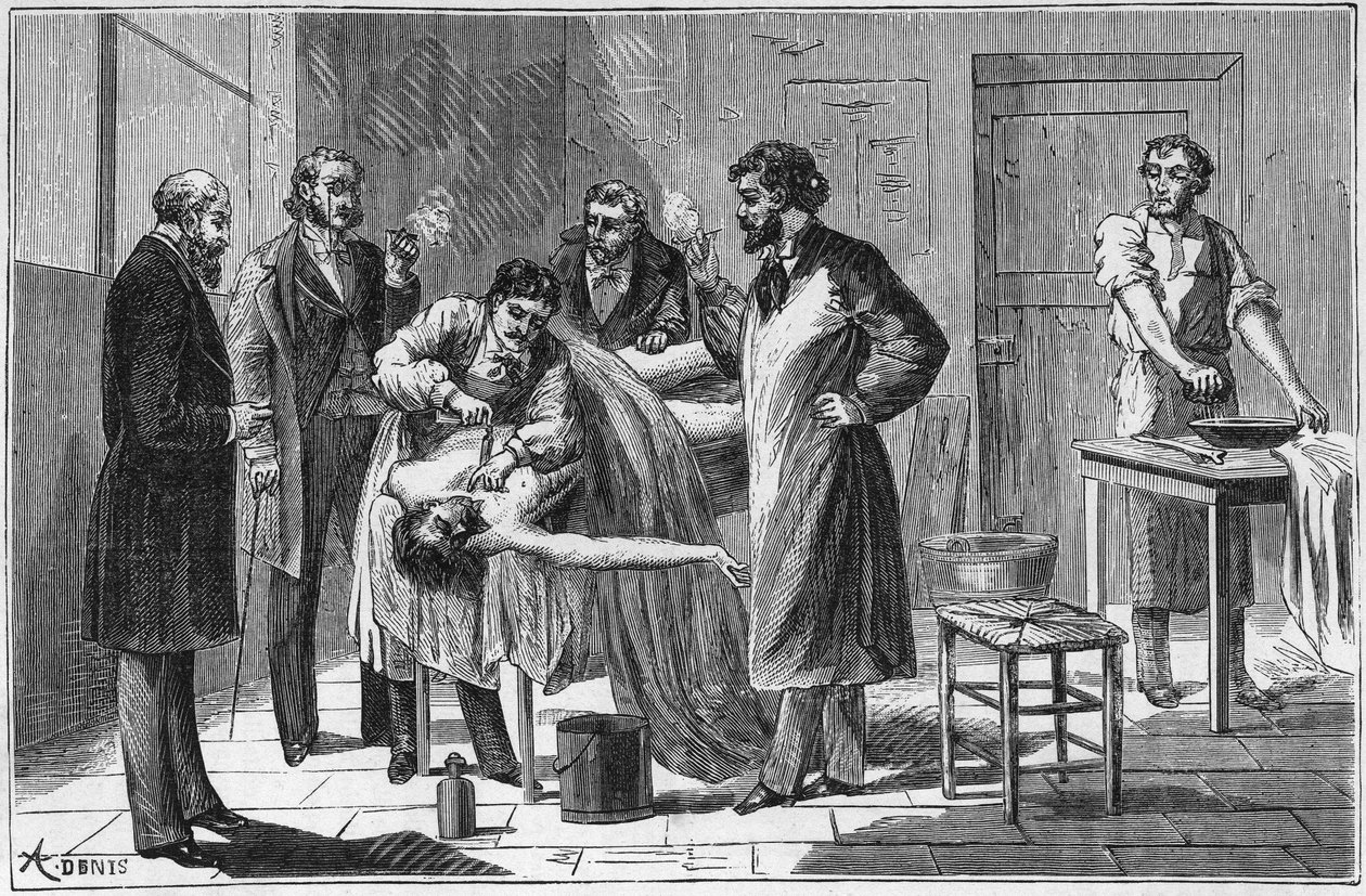 Použití siřičitanu sodného v pitevních amfiteátrech k uchování mrtvol - Rytí do "" Vědy dostupné všem - Populární fyzika a chemie"" od Alexise Clerca - Konec 19. století - Soukromá sbírka. od French School