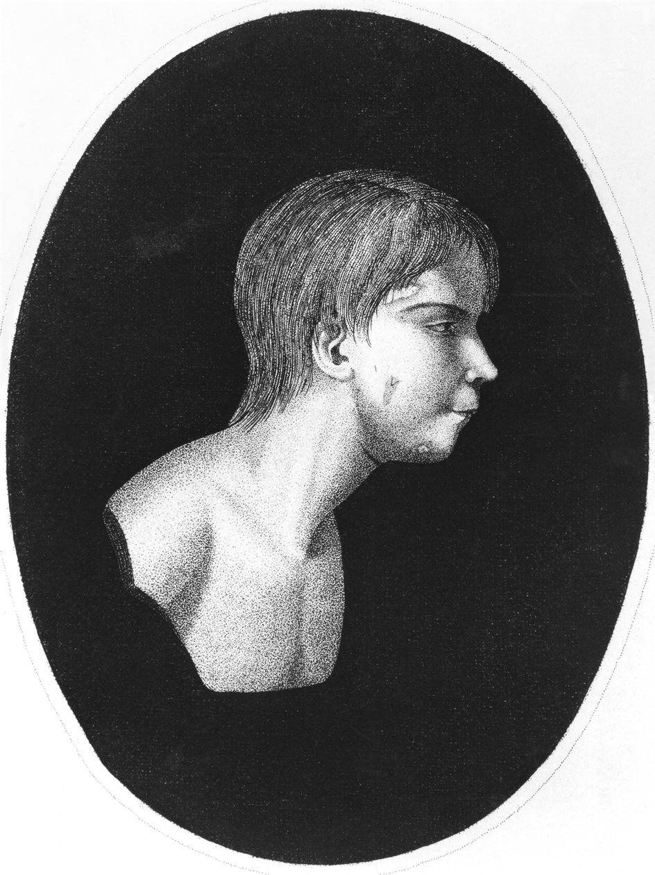 Victor of Aveyron, přední díl De lEducation dun homme sauvage od J.E.Itarda od French School