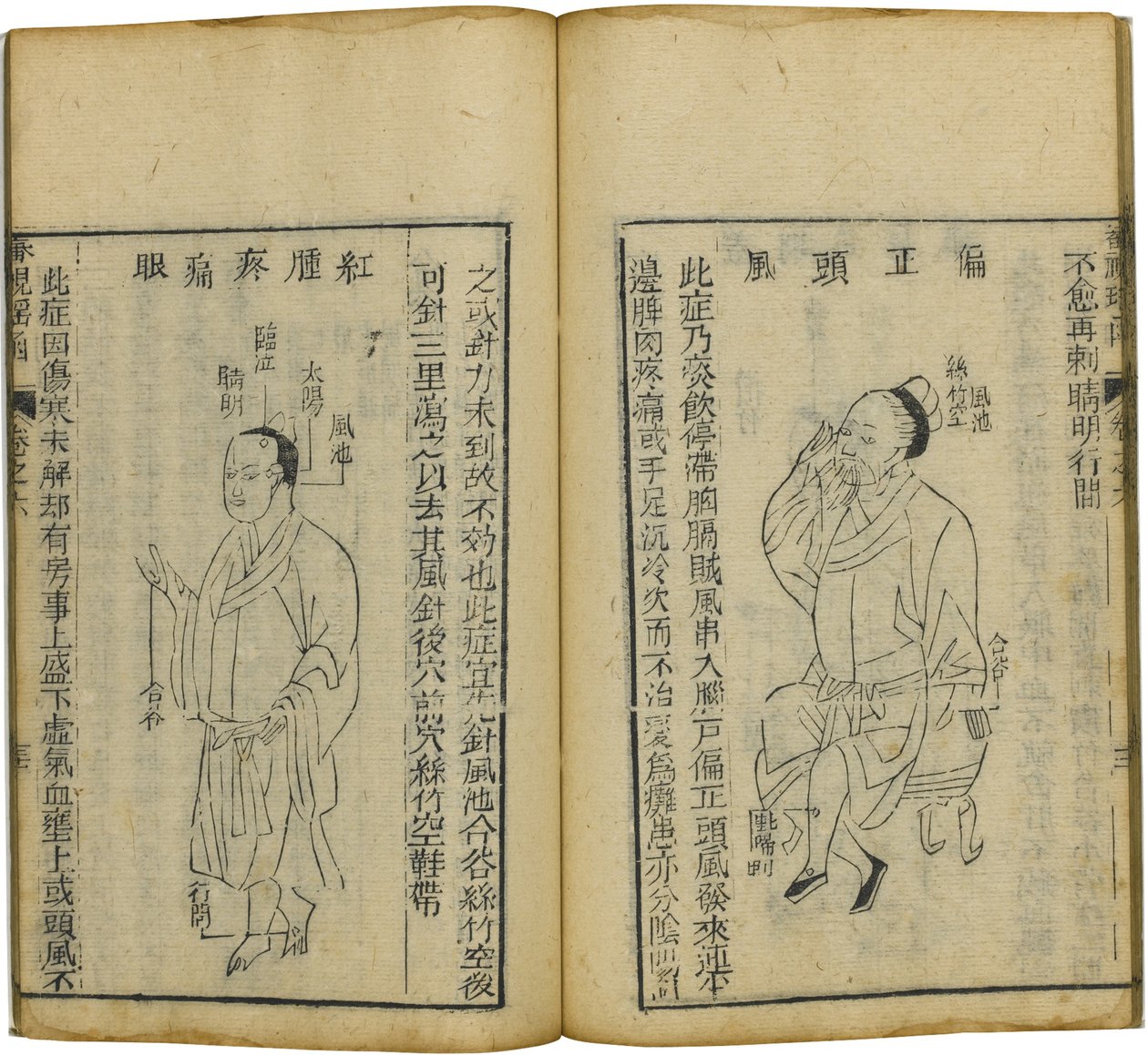 Shen Shi Yao Han Vzácná kniha oftalmologie, 1644 od Fu Renyu