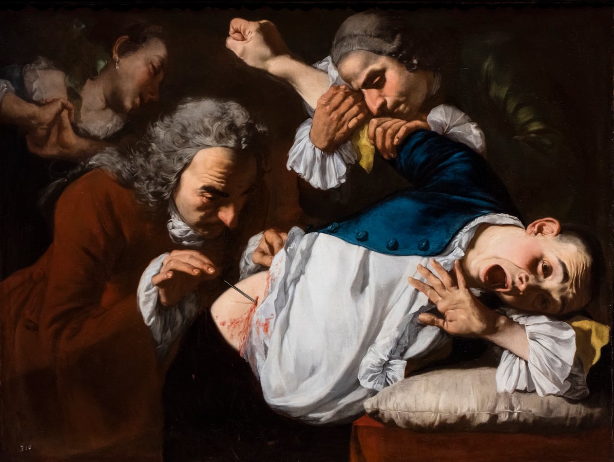 Operace, asi 1753/54 (olej na plátně) od Gaspare Traversi