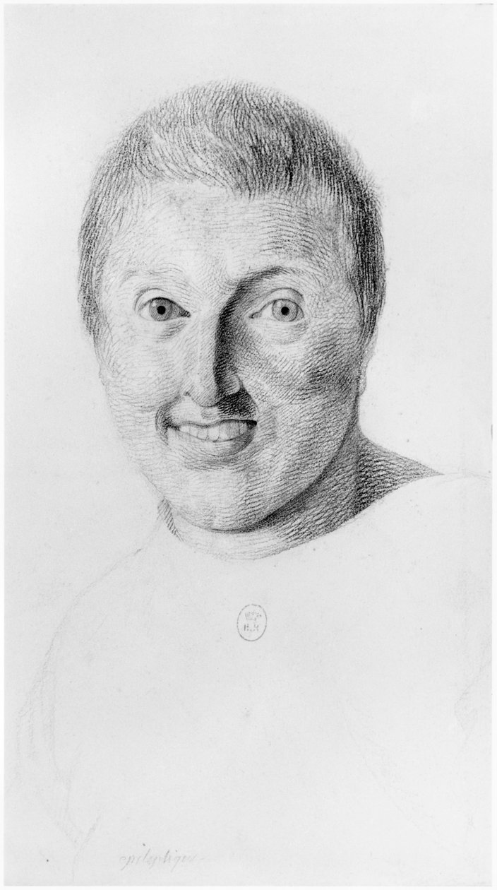 Epileptická žena, čelní pohled, ilustrace z nepublikovaného pojednání Jean Etienne Dominique Esquirol (1772-1840) o šílencích z blázince Salpetriere, kolem roku 1818 od Georges Francois Gabriel