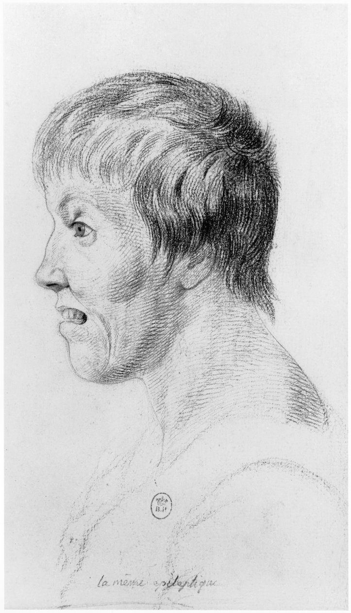 Epileptická žena, profil, ilustrace z nepublikovaného pojednání Jean Etienne Dominique Esquirol (1772-1840) o šílencích z blázince Salpetriere, kolem roku 1818 od Georges Francois Gabriel