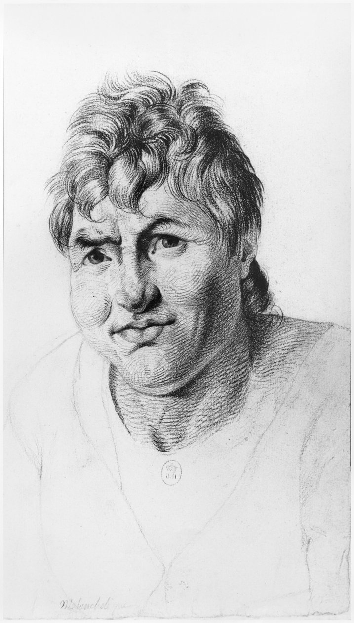 Melancholik, ilustrace z nepublikovaného pojednání Jean Etienne Dominique Esquirol (1772-1840) o šílencích z blázince Salpetriere, kolem roku 1818 od Georges Francois Gabriel