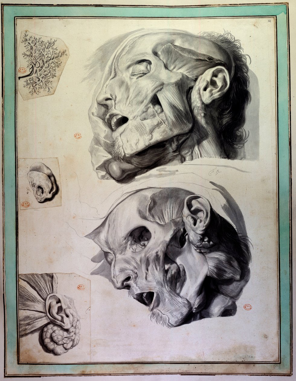 Lidské hlavy zbavené kůry: jsou vidět svaly a kostry. Rytina Gerarda de Lairesse (1640-1711) ilustrující „Anatomia Humani Corporis“ od Goverta Bidloa (nebo Govarda) (1649-1713) Knihovna lékařské fakulty z 18. století v Paříži od Gerard de Lairesse
