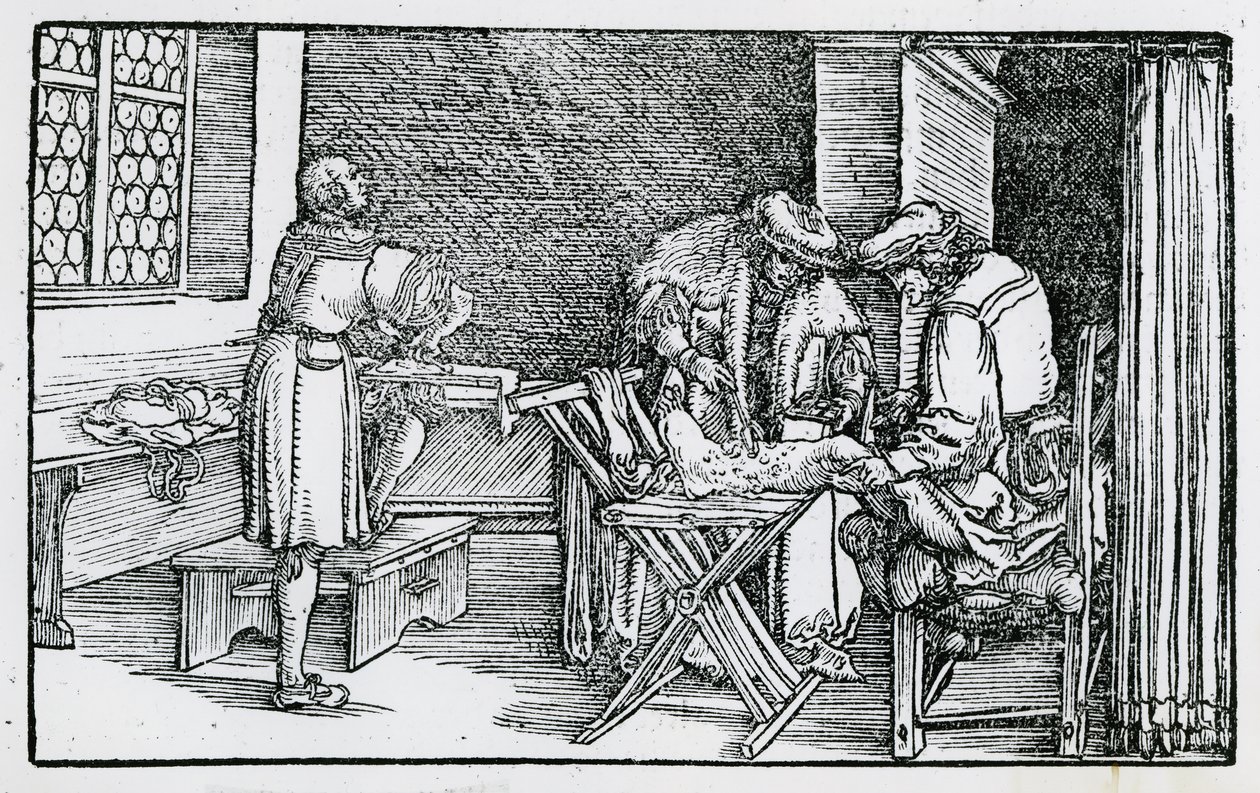 Léčba gangrénové nohy od German School