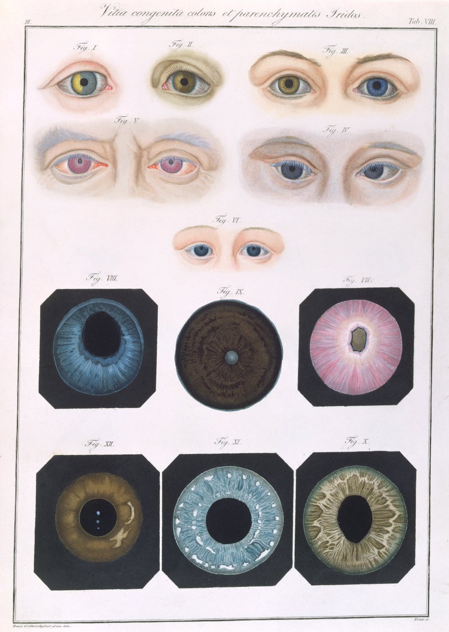 Popis vrozených očních anomálií, z Klinických popisů nemocí a zrakových vad lidského oka, Friedrich August von Ammon (1799-1861) 1838 od German School