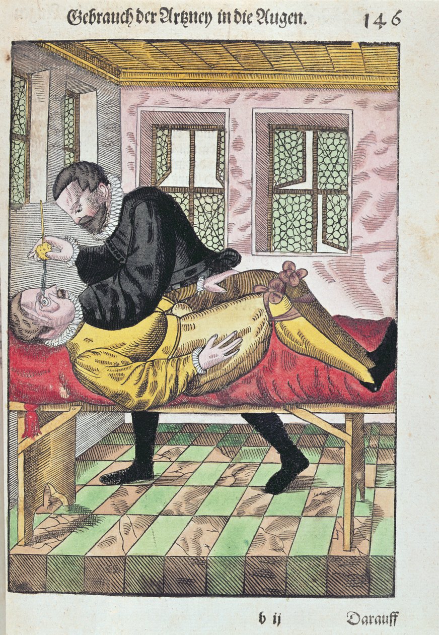 Operace očí, z Ophthalmodouleia od Georga Bartische (1535-1636), vydaná v Drážďanech v roce 1583 (barevný dřevořez) od German School