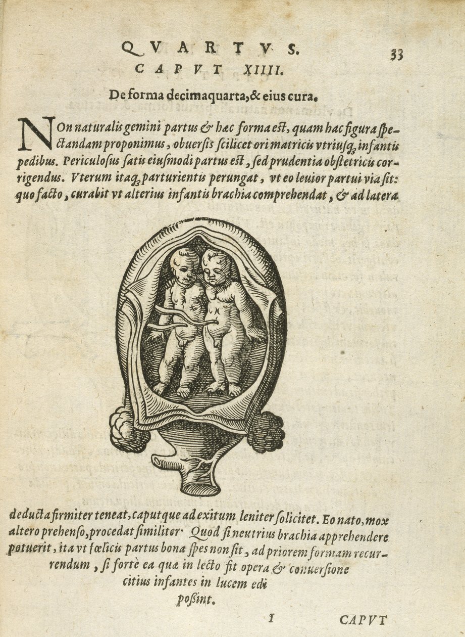 Neidentická dvojčata v lůně, ilustrace z kapitoly 14, kniha 4 knihy O početí a růstu člověka od Rueff, 1587 od German School