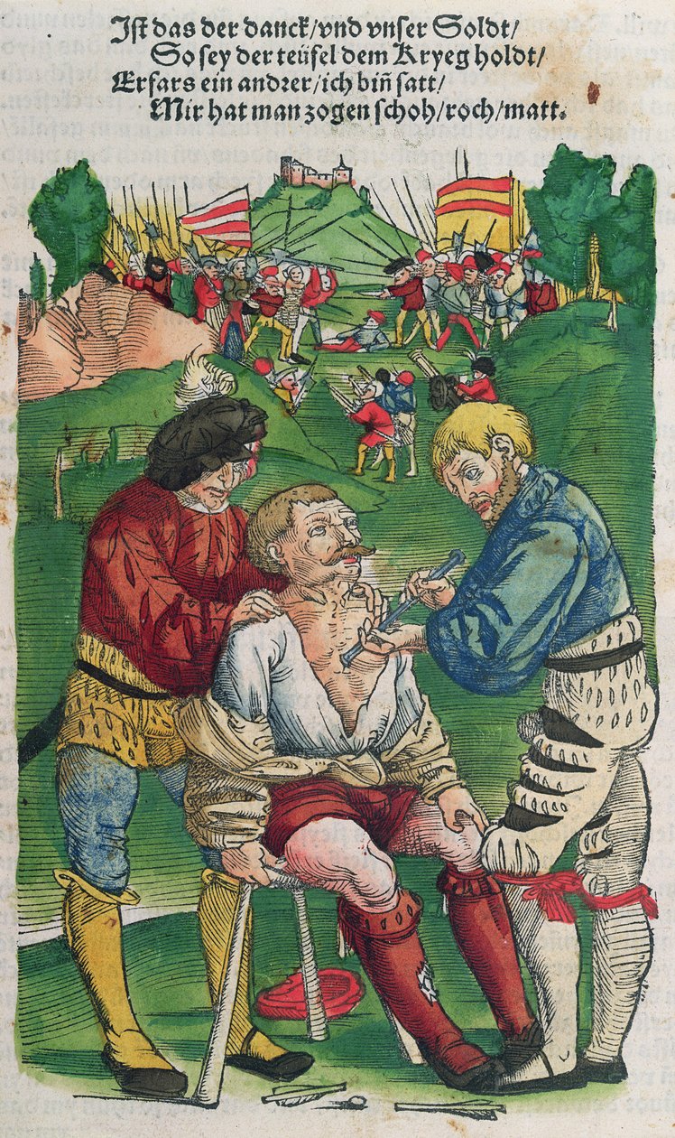 Odstranění šípu, ilustrace z Feldtbuch der Wundartzney od Hanse von Gersdorffa, 1540 od German School