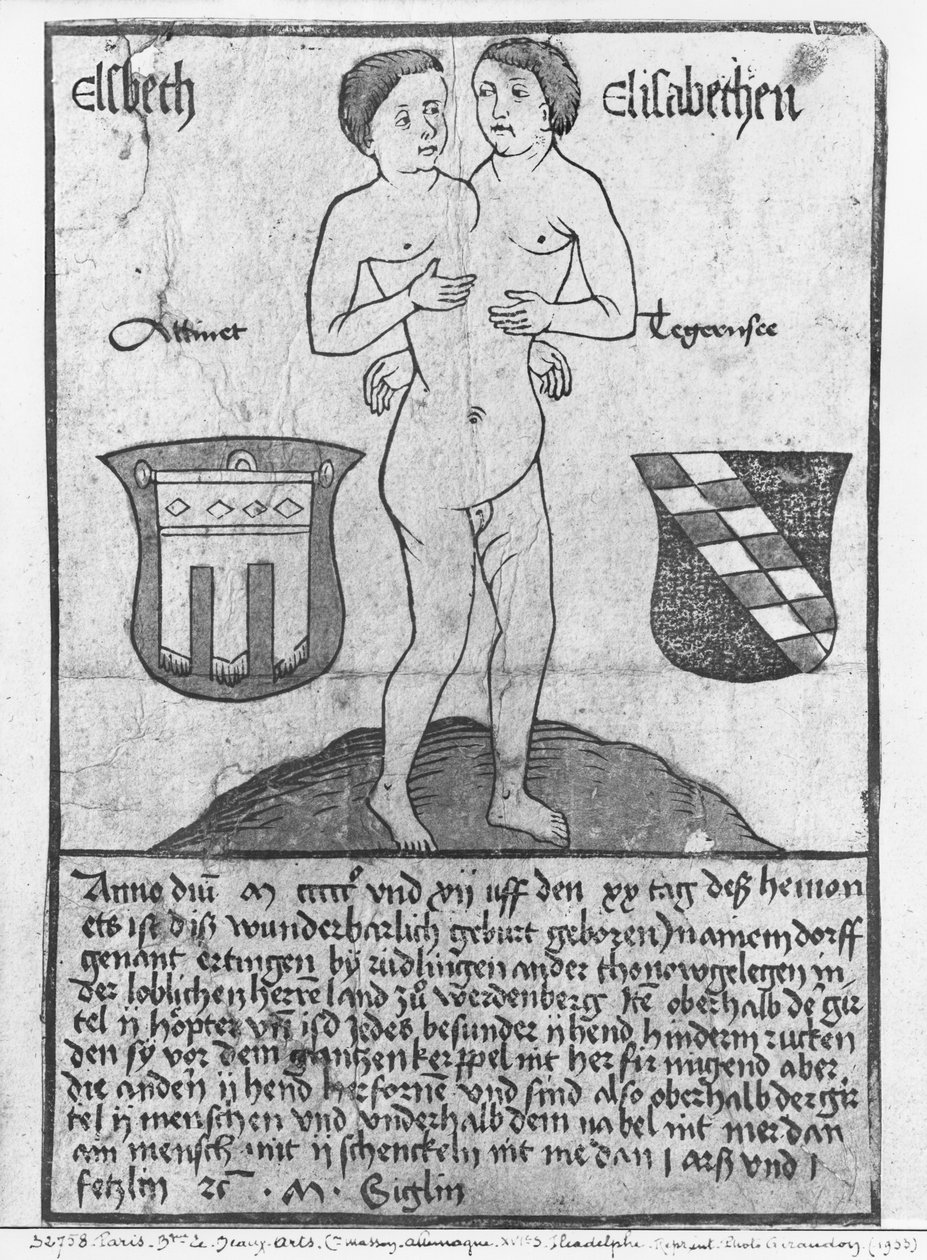 Siamské dívky, Elsbeth a Elisabethen (dřevořez a wc) od German School