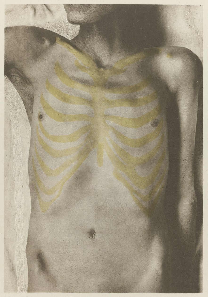 Anatomické foto van een mannelijk lijk: 