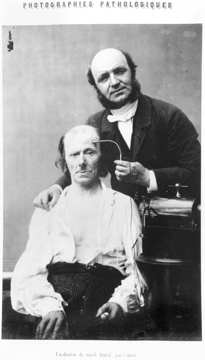 Faradizace čelního svalu, z „Album de photographies pathologiques“ od Duchenne de Boulogne, vydané 1862, Paříž od Guillaume Benjamin Armand Duchenne de Boulogne