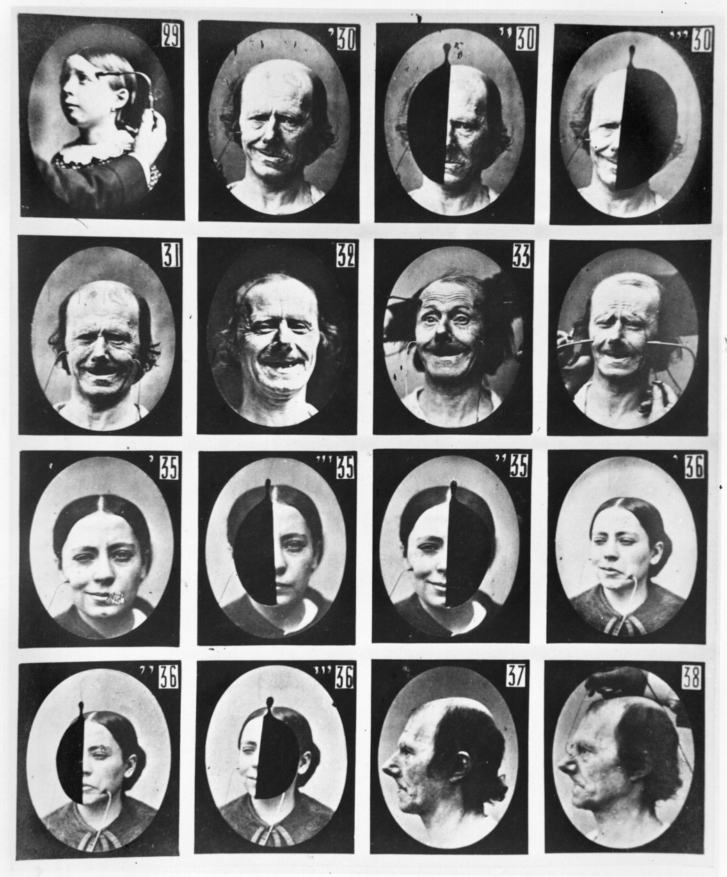 Fyziognomické studie z „Mechanismu lidské fyziognomie nebo elektrofyziologické analýzy vášní“ od Duchenne de Boulogne, publikované 1876, Paříž od Guillaume Benjamin Armand Duchenne de Boulogne