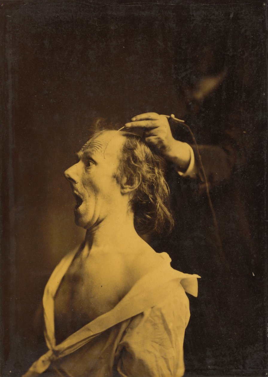 Úžas, ohromení, ohromení,1854-1856, vytištěno 1862 (foto) od Guillaume Benjamin Armand Duchenne de Boulogne