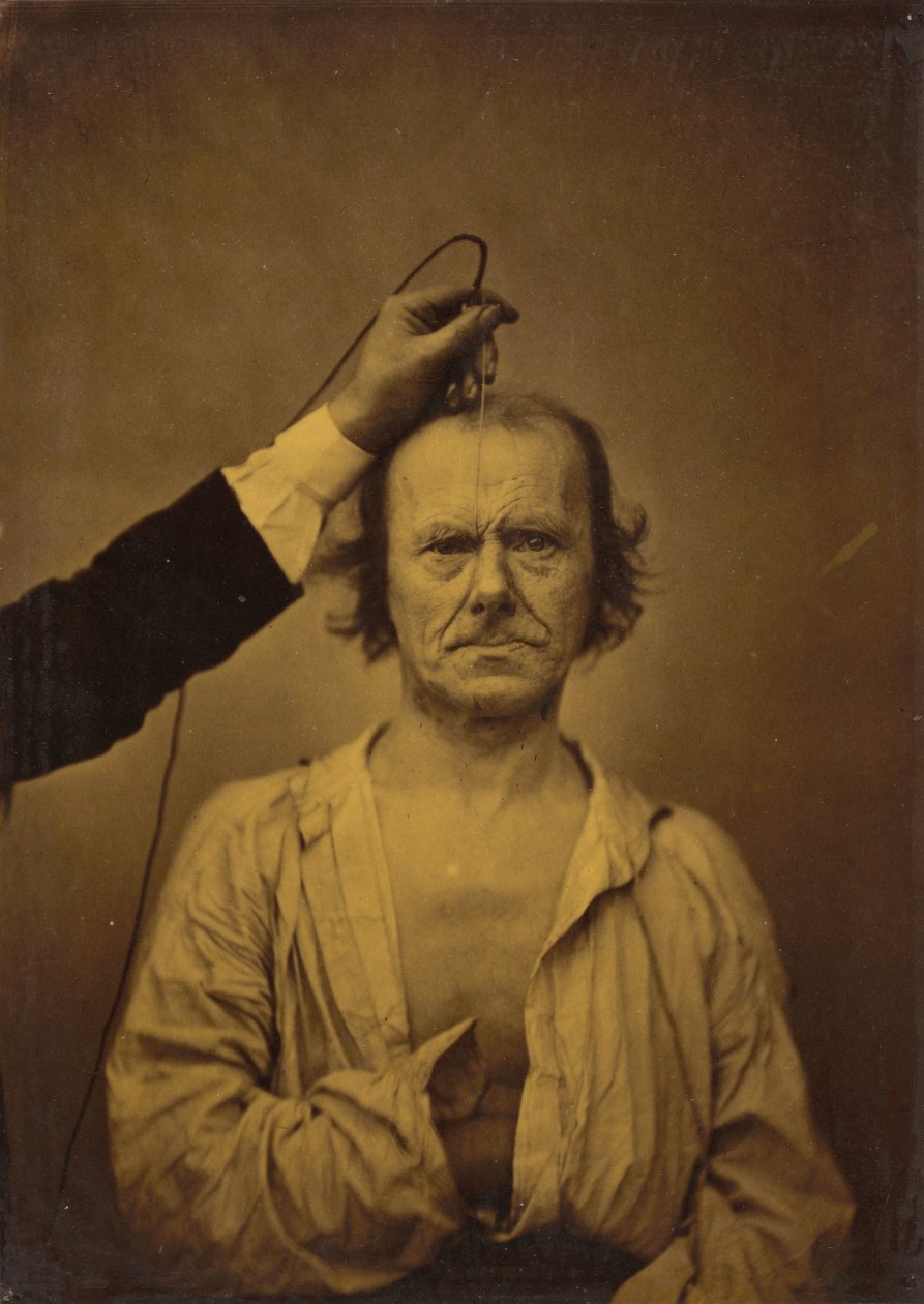 Pozornost (vlevo); Severita, agrese (vpravo),1854-1856, vytištěno 1862 (foto) od Guillaume Benjamin Armand Duchenne de Boulogne