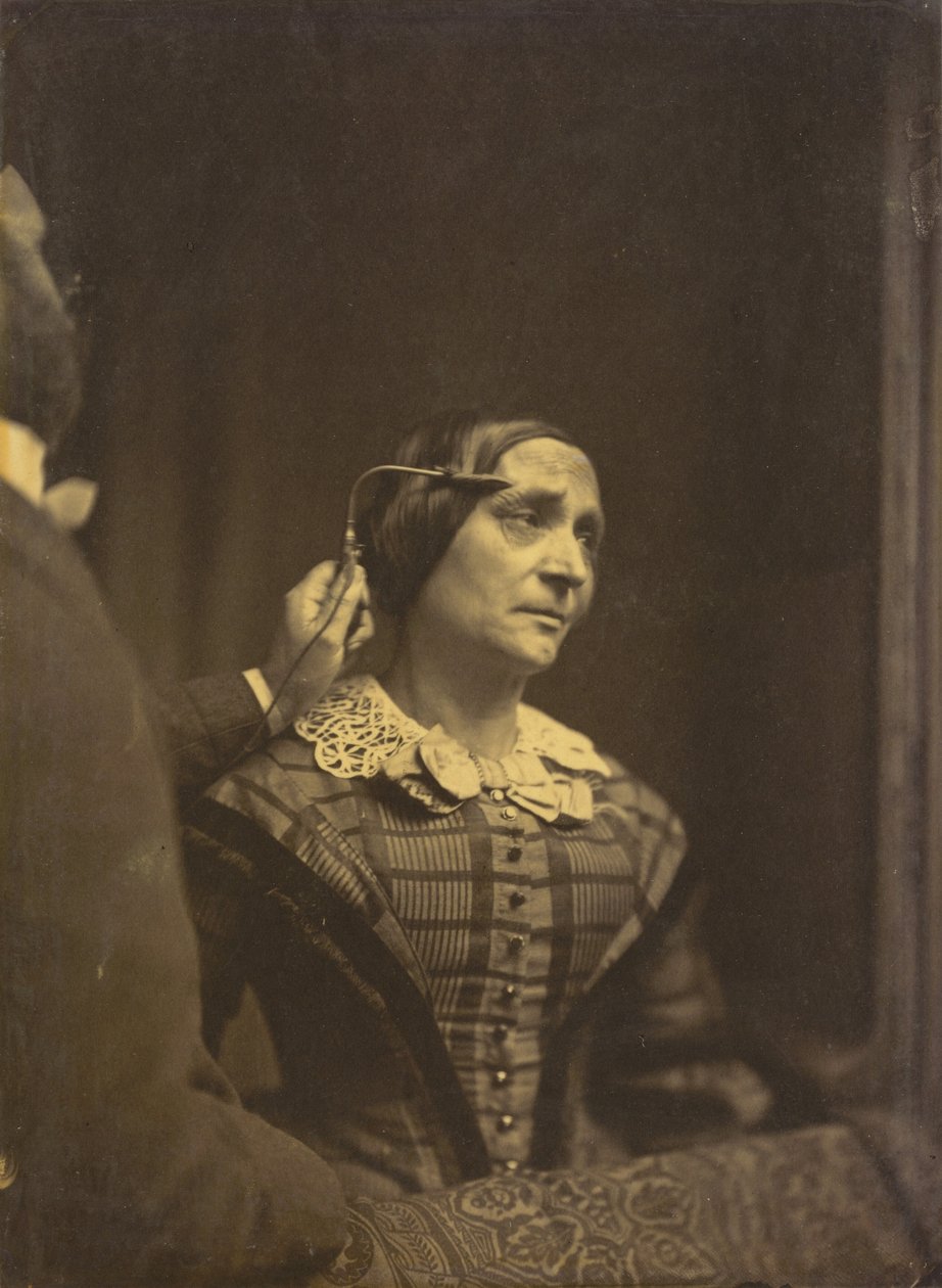 Pozornost, pozorný pohled (vlevo); Bolestná pozornost (vpravo),1854-1856, vytištěno 1862 (foto) od Guillaume Benjamin Armand Duchenne de Boulogne