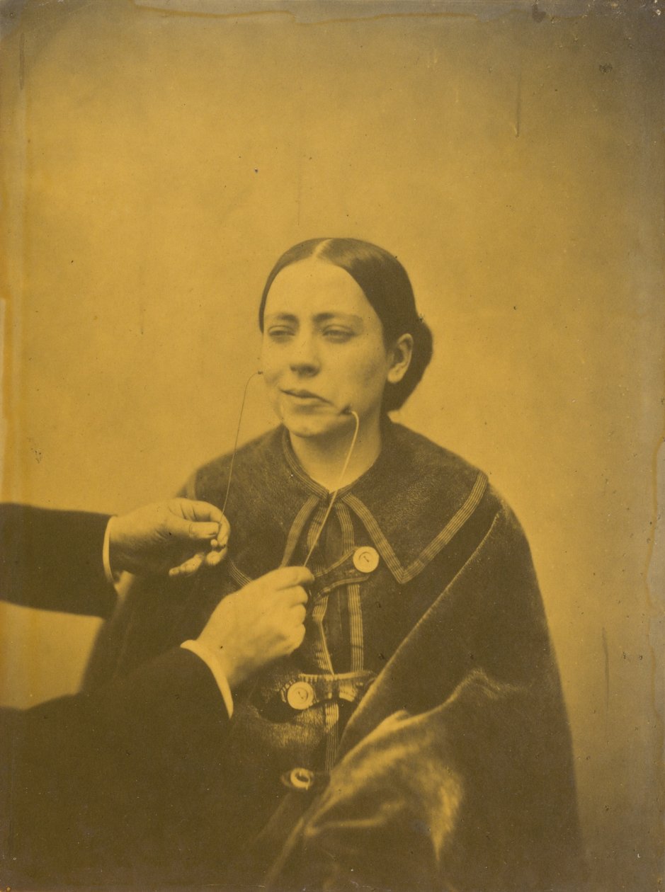 Pohrdavé znechucení (vlevo); Pohrdavý smích (vpravo),1854-1856, vytištěno 1862 (foto) od Guillaume Benjamin Armand Duchenne de Boulogne