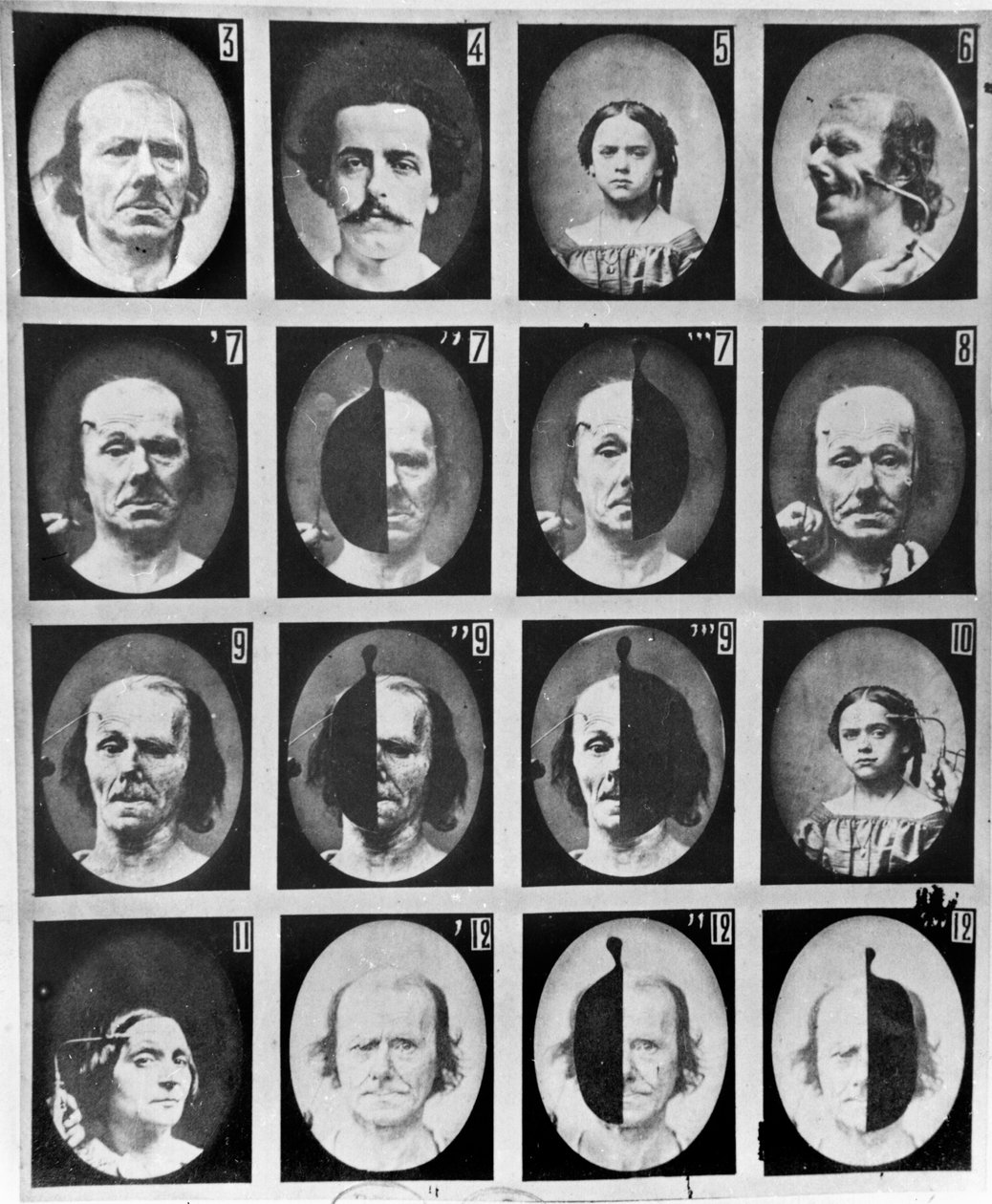 Fyziognomické studie z „Mechanismu lidské fyziognomie nebo elektrofyziologické analýzy vášní“ od Duchenne de Boulogne, publikované 1876, Paříž od Guillaume Benjamin Armand Duchenne de Boulogne
