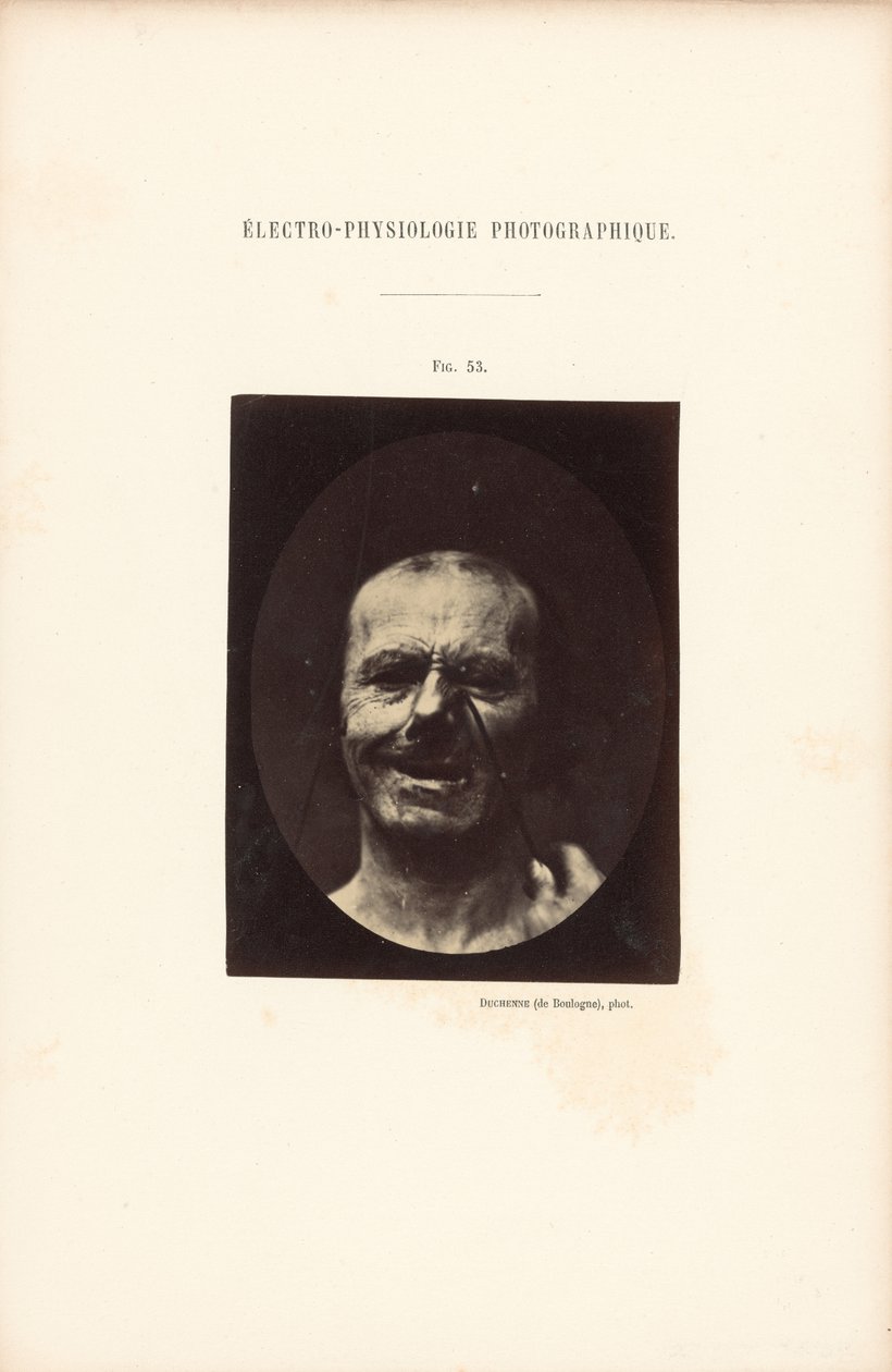 Fotografická elektrofyziologie, obrázek 53 od Guillaume Benjamin Duchenne