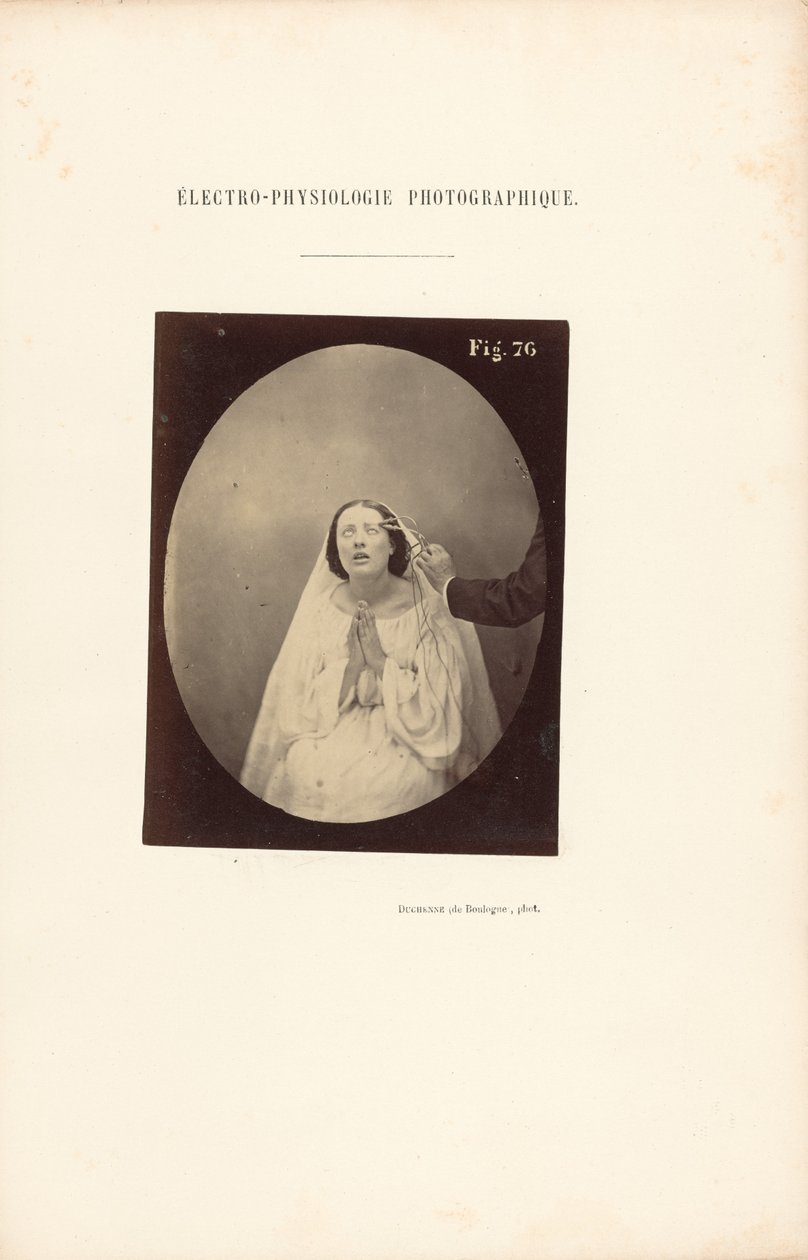 Fotografická elektrofyziologie, obrázek 76 od Guillaume Benjamin Duchenne