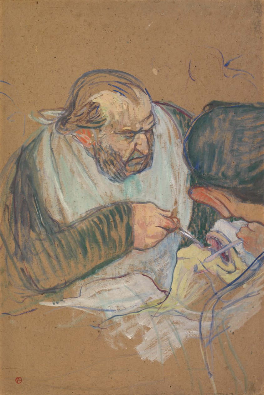Dr. Péan operuje od Henri de Toulouse-Lautrec