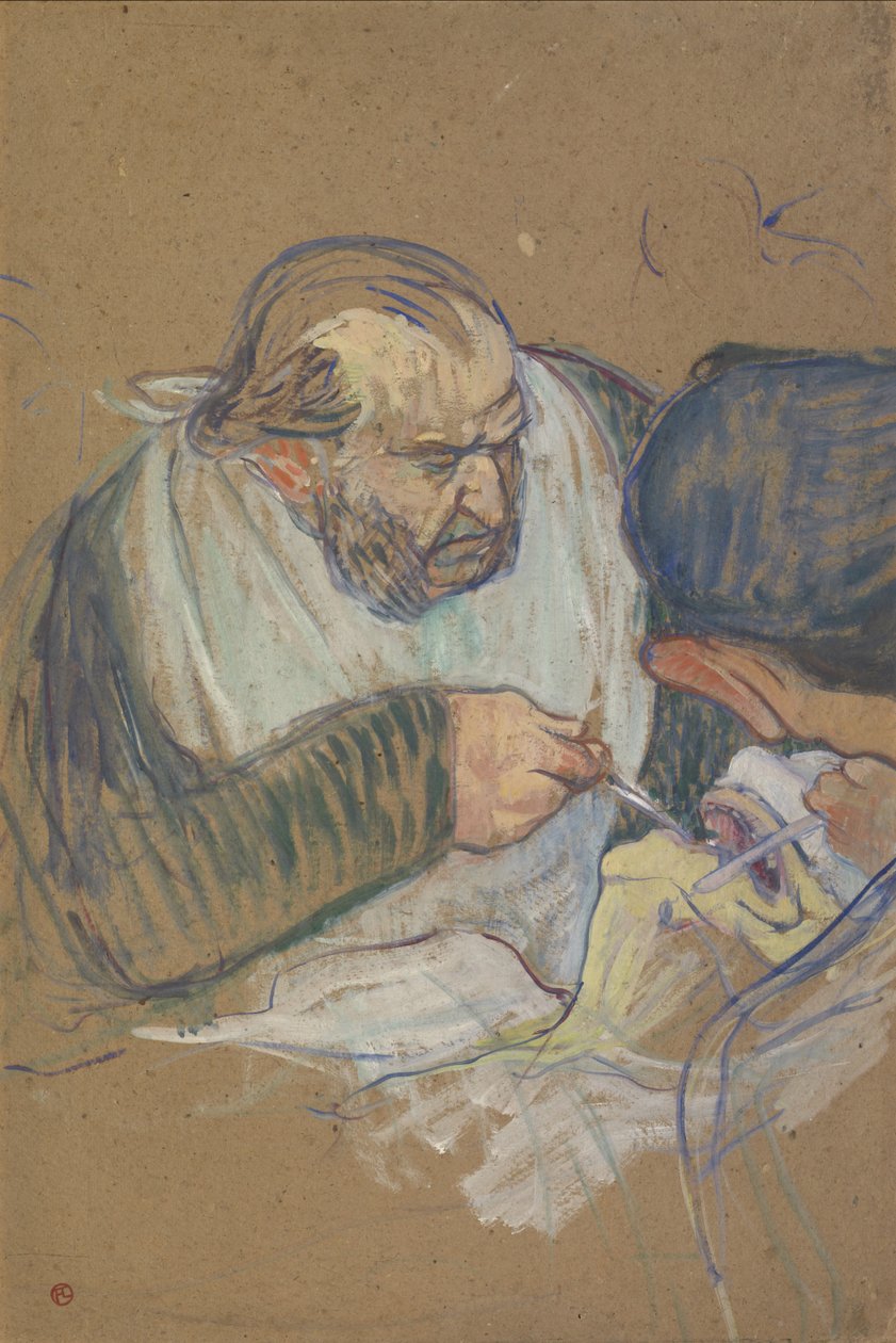 Dr. Péan Operations, 1891-92 od Henri de Toulouse Lautrec