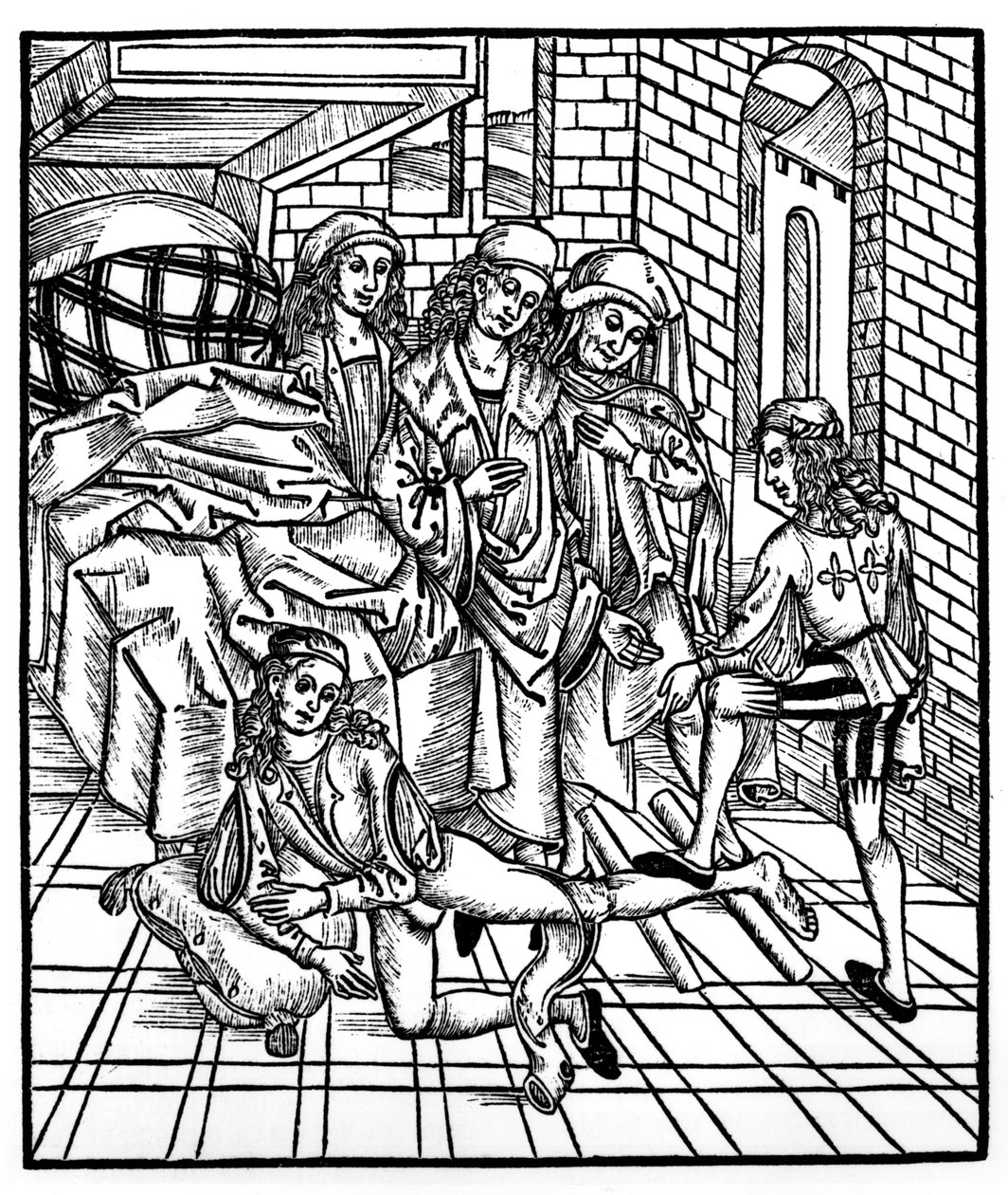 Chirurg řídí jako asistent zlomení a resetování nohy, z „Das Buch der Cirugia“, vydáno ve Štrasburku, 1497 od Hieronymus Brunschwig
