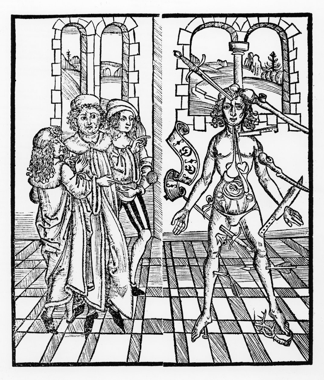 Zraněný muž z „Das Buch der Cirugia“ vydaného ve Štrasburku, 1497 od Hieronymus Brunschwig