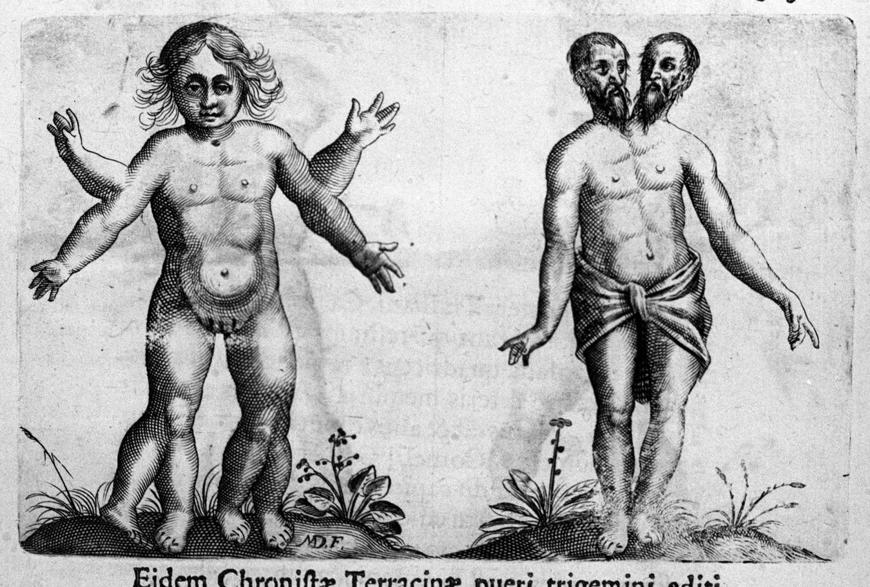 Různé typy lidských monster Rytina z "Povaha monster, jejich příčiny a rozdíly" od Fortunia Ačkoliiho (1577-1656), italského vědce. 1646 od Italian School