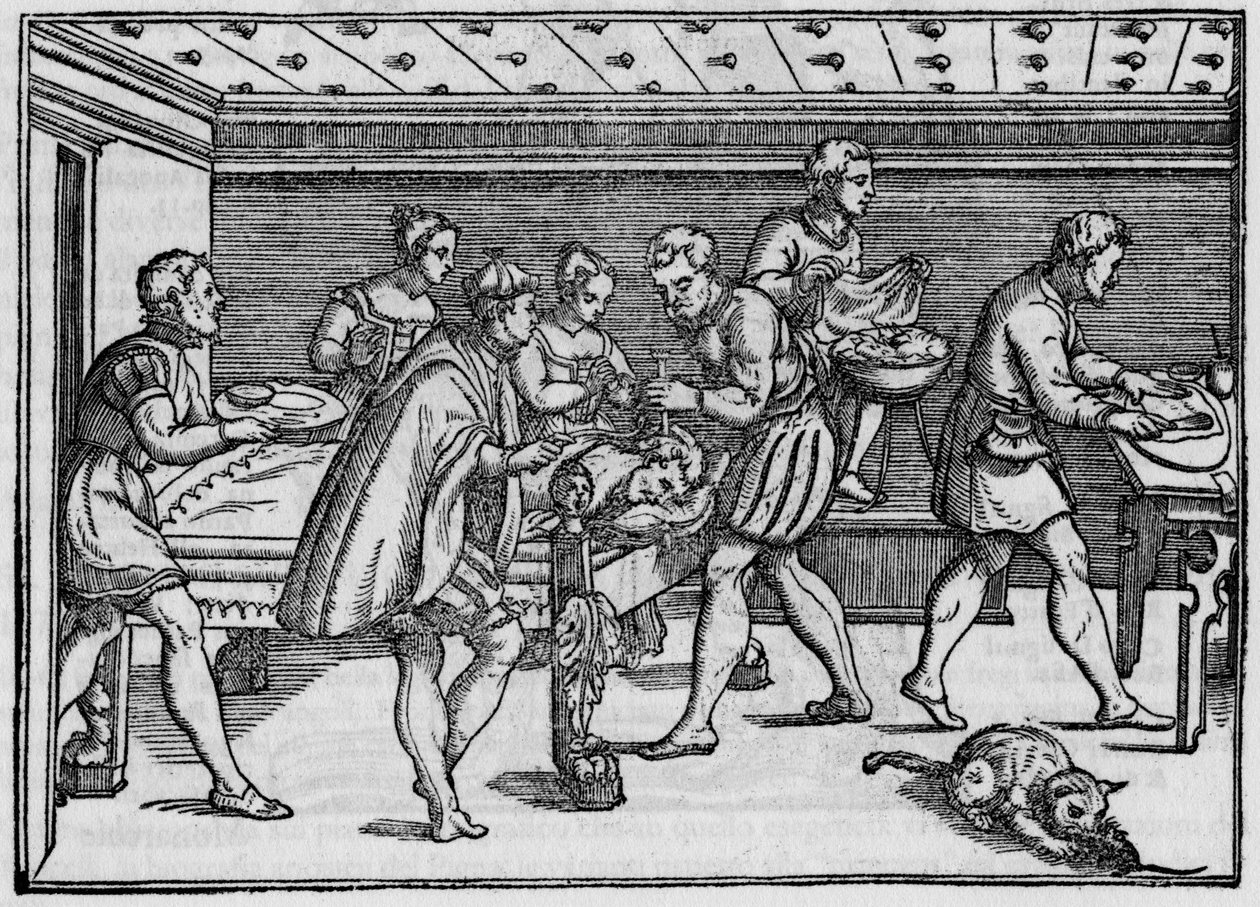 Rytina 1574 v "" Della Cirurgia "" "(O operaci) od italského chirurga Giovanni Andrea dalla Croce. od Italian School
