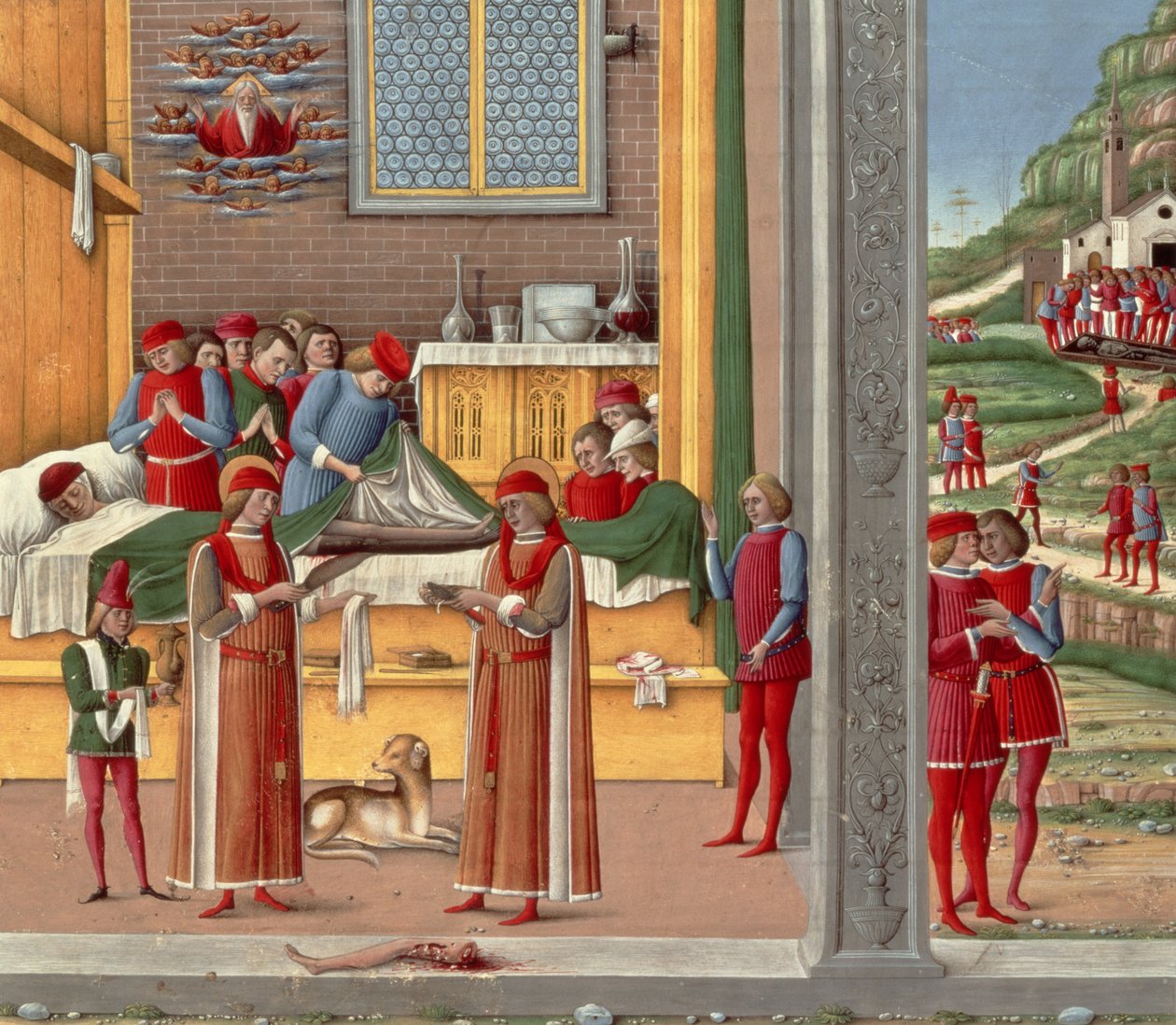 Středověká amputační scéna (tempera na panelu) od Italian School