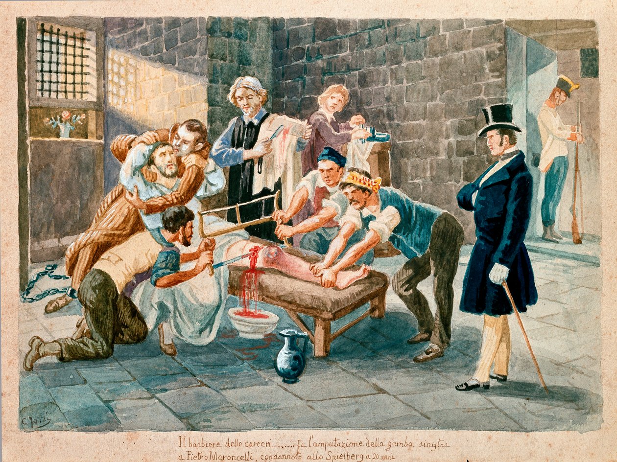 Patriotovi a členu Carboneria (karbonarismu) Pietru Maroncellimu (1795-1846) byla během věznění v káznici pevnosti Spielberg na Moravě amputována noha. Tisky z 19. století Museo del Risorgimento, Milán od Italian School