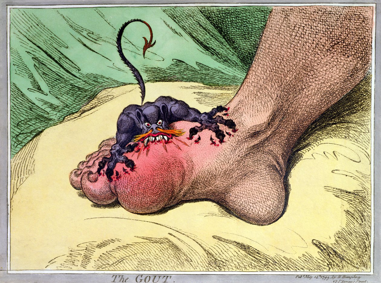 The Gout, vydané Hannah Humphrey v roce 1799 (ručně kolorovaný měkký lept) od James Gillray