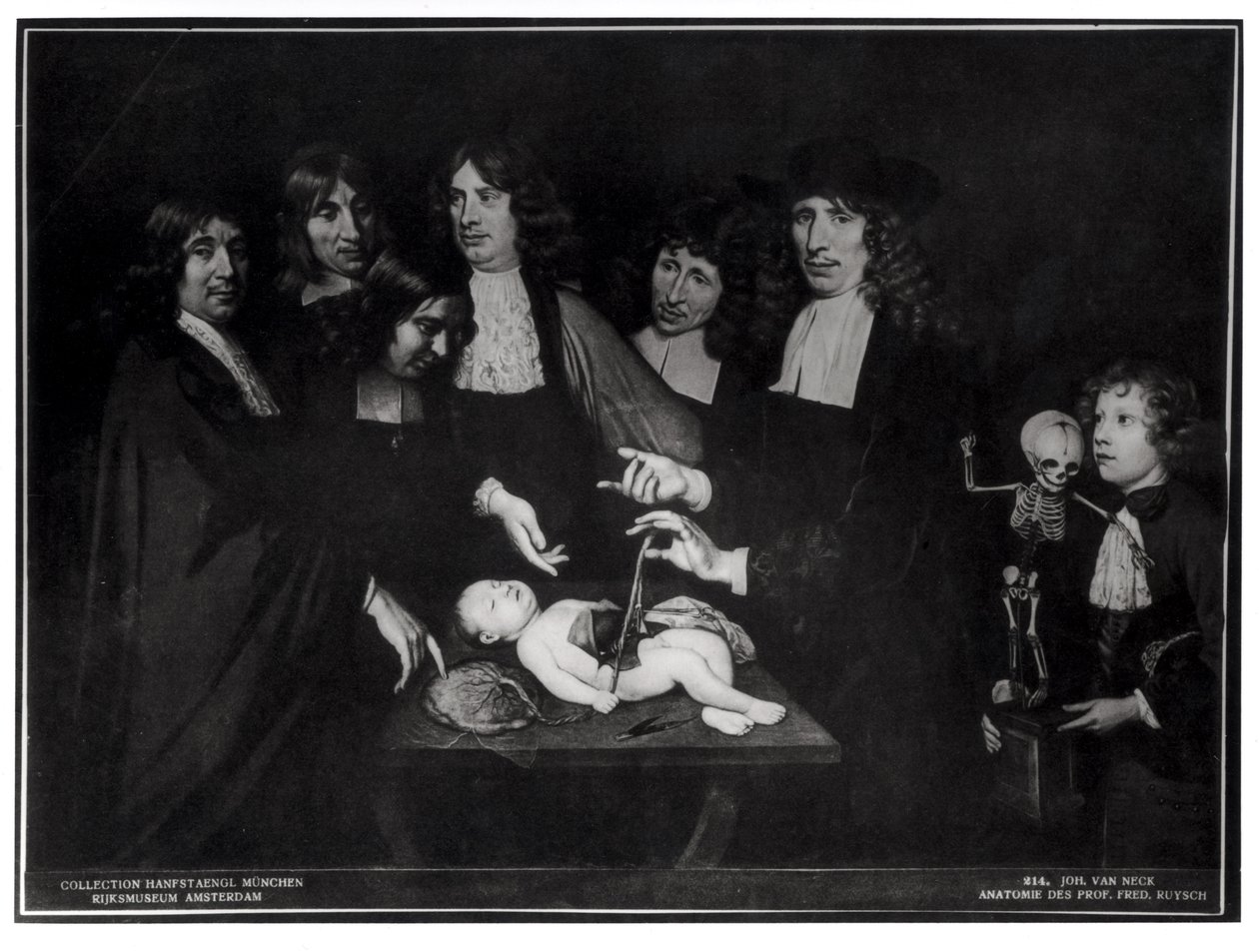 Lekce anatomie profesora Frederika Ruysche (1638-1731) kolem roku 1683 od Jan van Neck