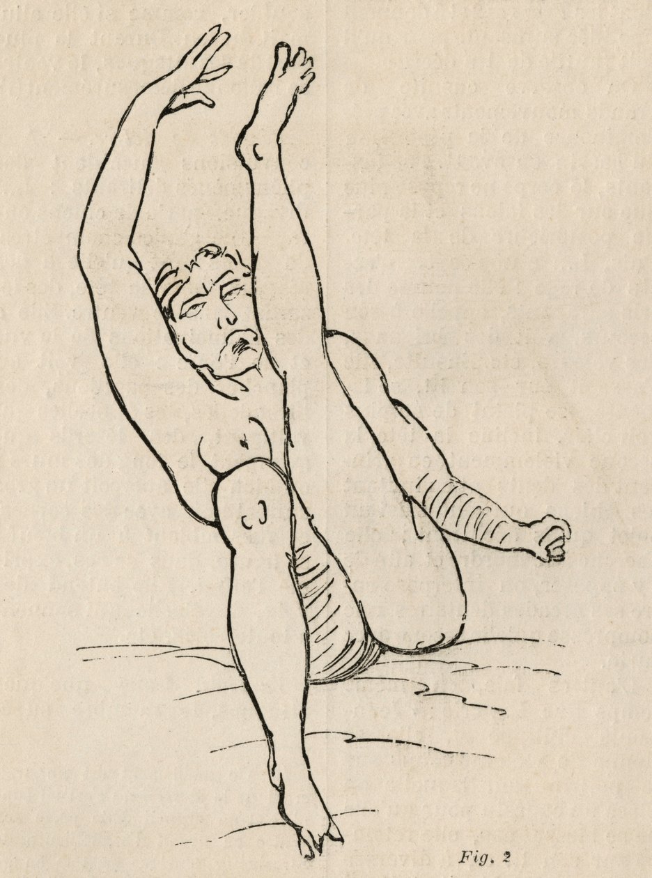 Hysterická epilepsie, záchvat, zkroucení, obr. 2 z 