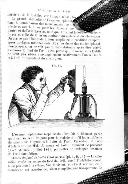 Ilustrace z "Traite Pratique des Maladies des Yeux", překladu "A Manual on the Principles and Practice of Ophthalmic Medicine and Surgery", Thomas Wharton Jones (1808-91), vydal E. Foucher, Paříž 1862 (rytina) (čb foto) od Jean Francois Badoureau