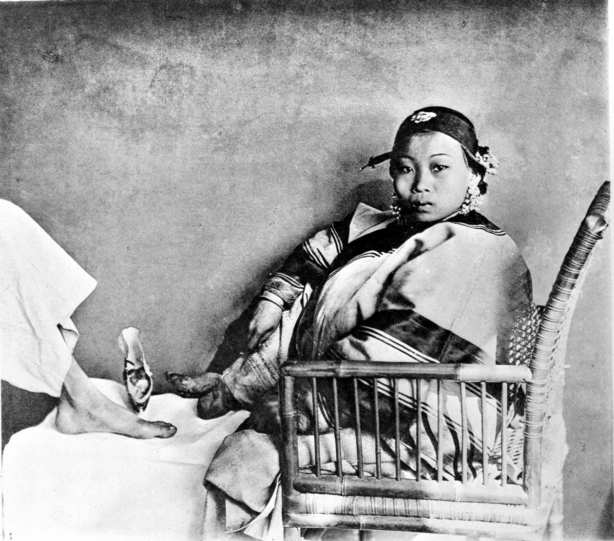 Žena ukazující svou nohu zmrzačenou nošením tradičních bot vedle evropské nohy (foto) od John Thomson