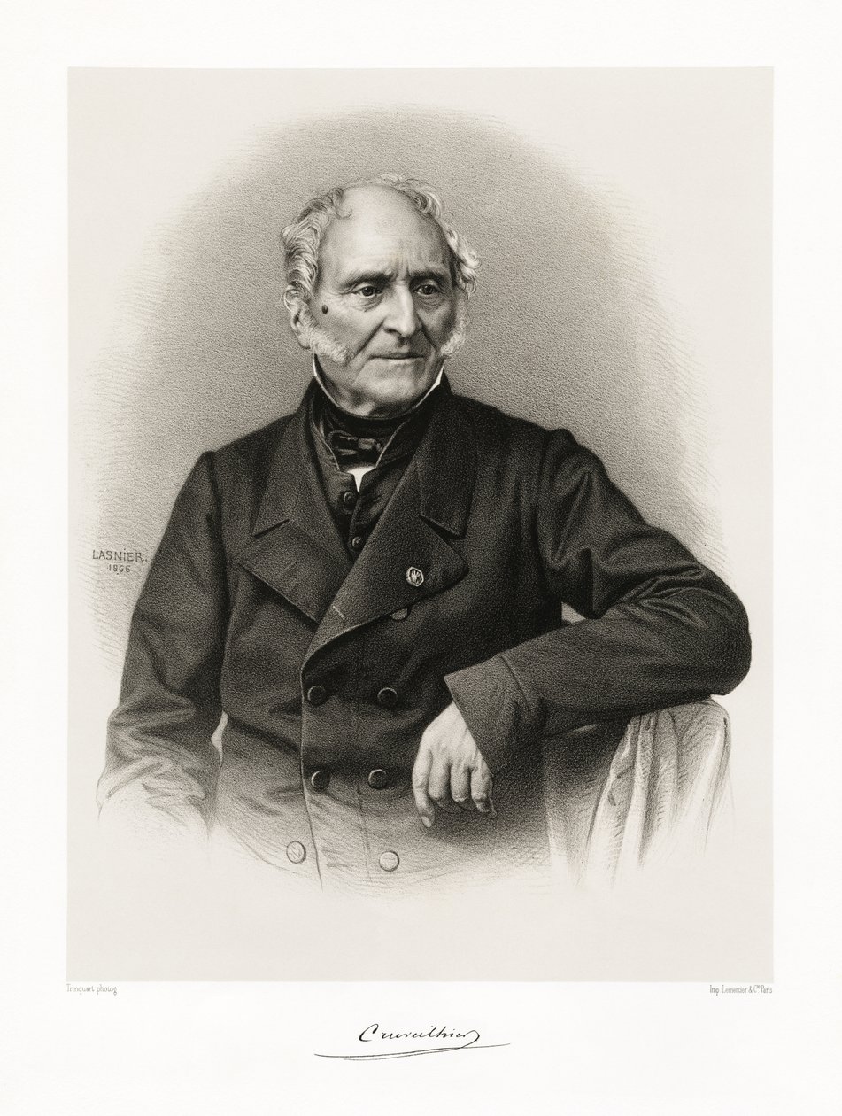 Jean Cruveilhier, 1865-66 od Lasnier