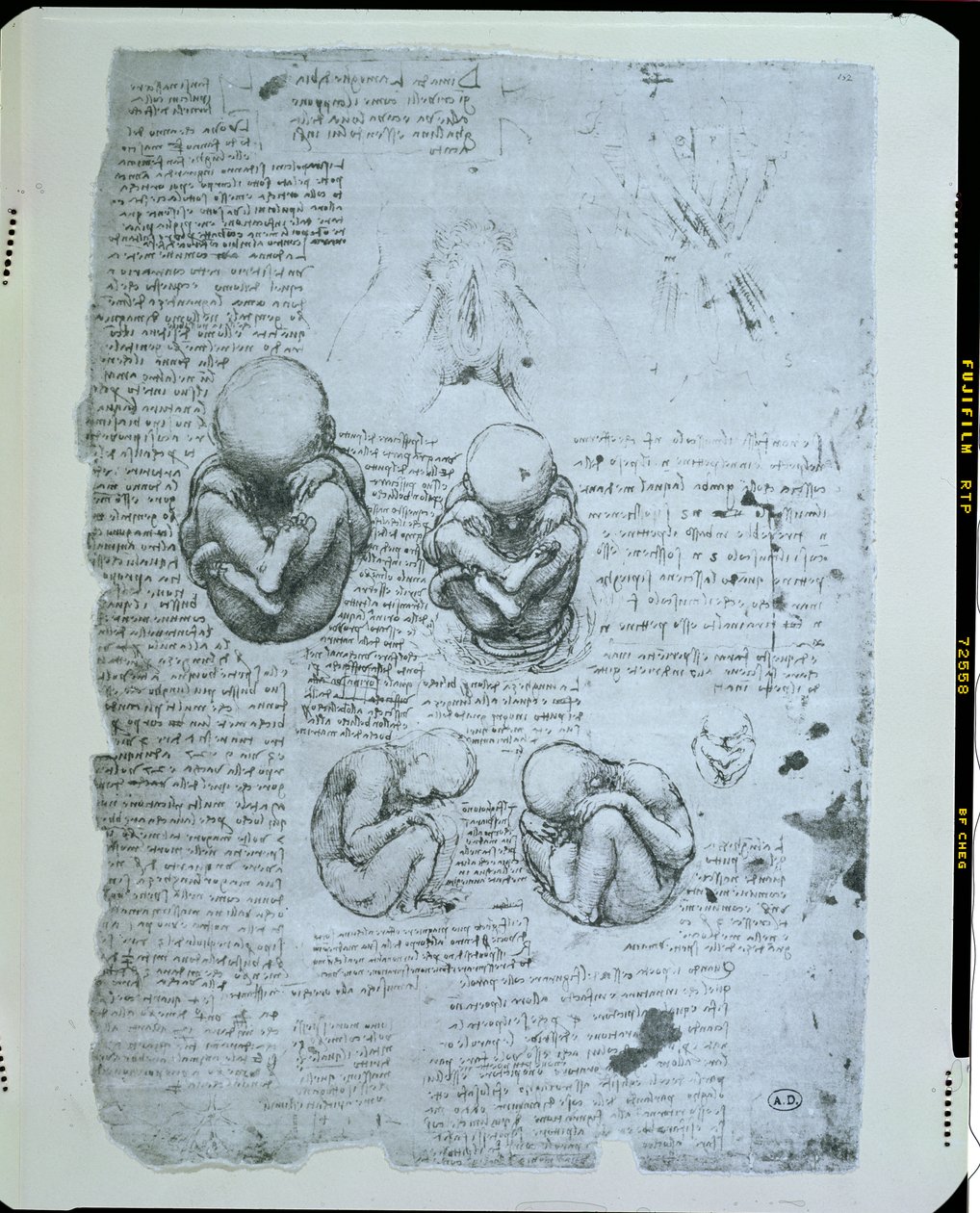 Pět pohledů na plod v děloze, faksimile kopie od Leonardo da Vinci