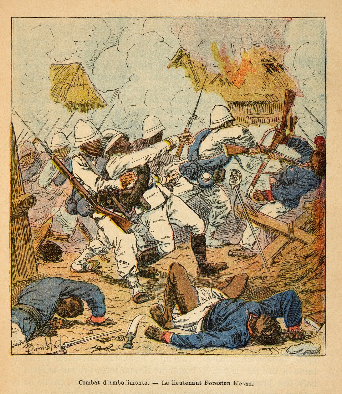Válka na Madagaskaru - neoficiální historie francouzských expedic 1885-1895 od Henri Galli dit Galllichet (1854-1922), ilustrované Louisem Bombledem (1862-1927): Zranění poručíka Forestona během bitev u Ambolomonty v roce 1895, Soukromá sbírka od Louis Charles Bombled