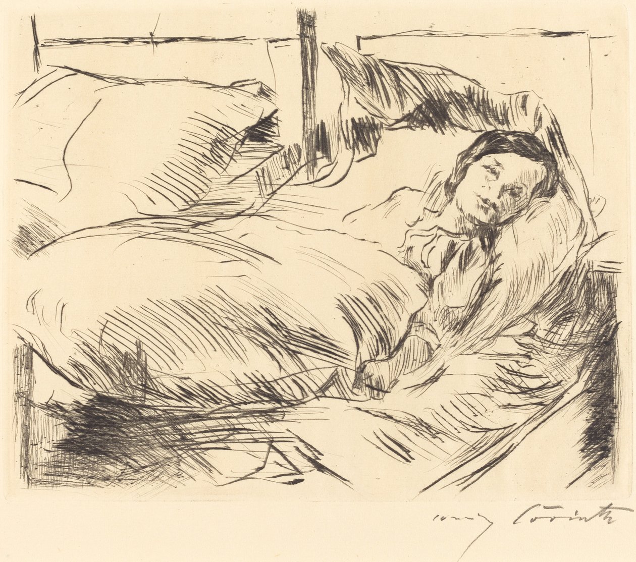 The Sick Child The Sick Child, 1918. od Lovis Corinth